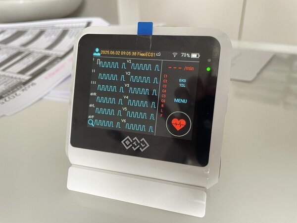 EKG1